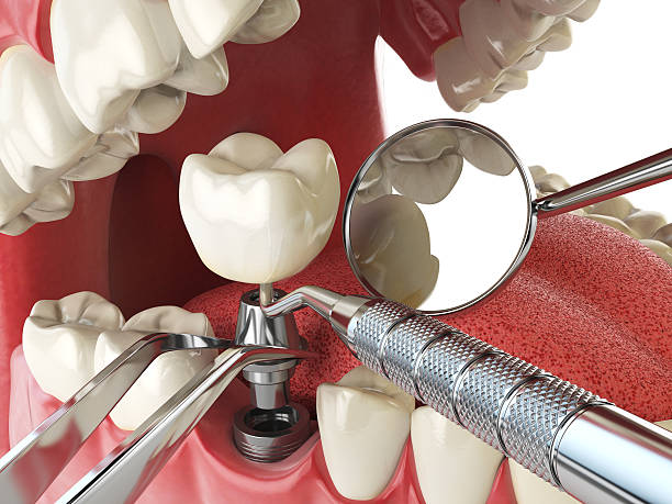 Best Emergency Broken Tooth Repair in Baxter Estates, NY